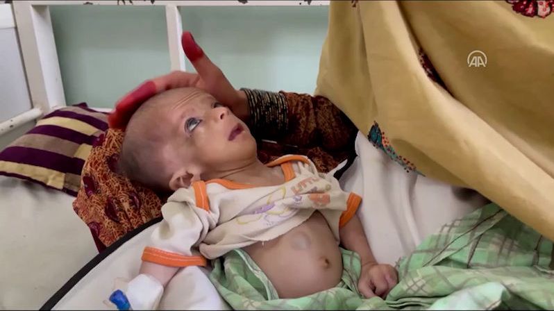 Hlad v Afghánistánu: Ohroženy jsou miliony dětí. Pomoc vázne a posiluje Islámský stát